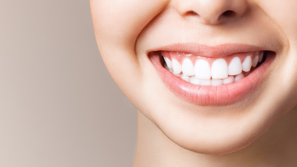 Woman with shiny, white teeth after getting her dental veneers.