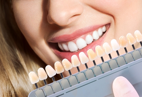 Still Dark After Home Whitening in Lakewood, CO? Here's Why.